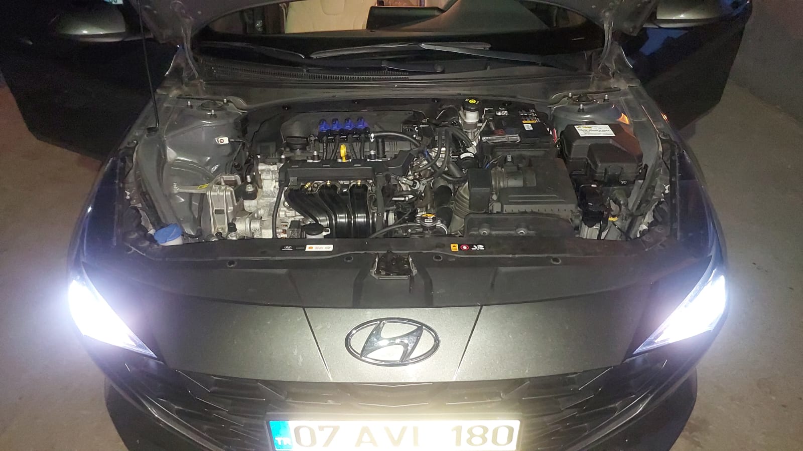 2021-hyundai-elentra-mpi-motor-8-enjeksiyon-prins-teknoma--twin-enjeksiyon-montaji_b136d.jpg